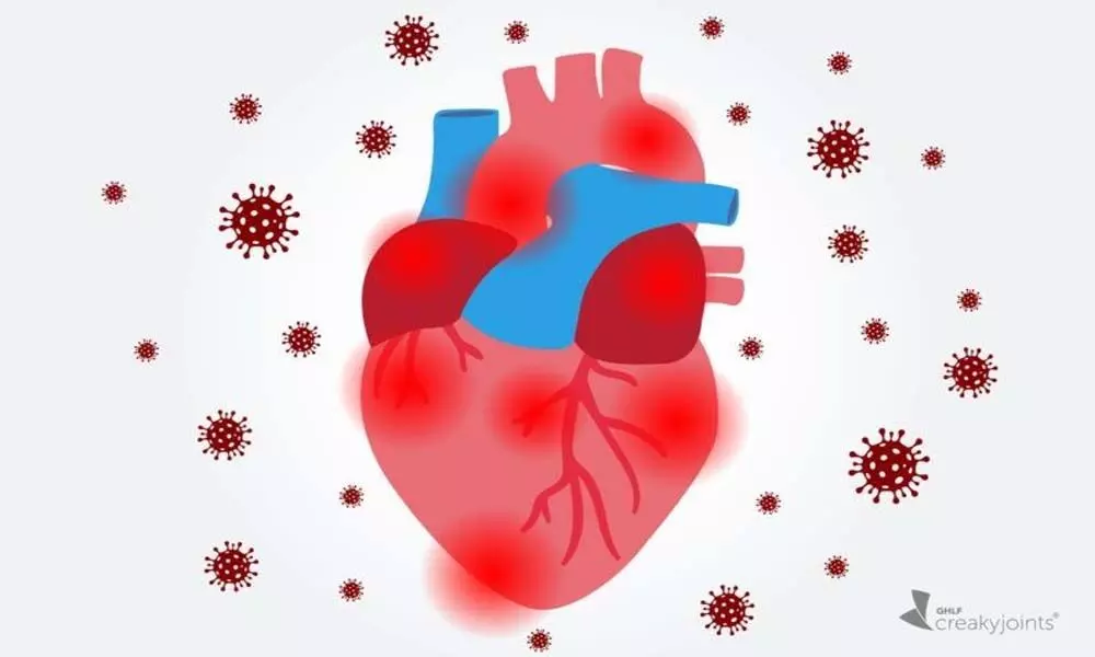 Heart inflammation more common after Covid