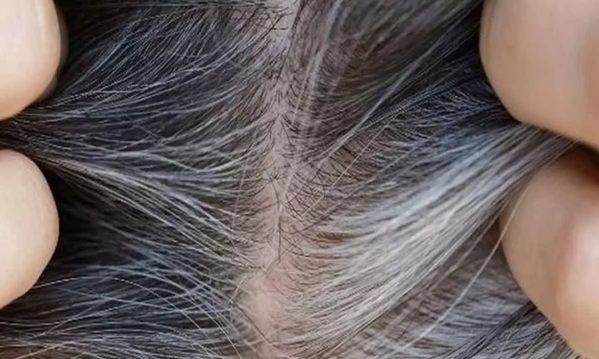 Scientists decode why our hairs turn grey