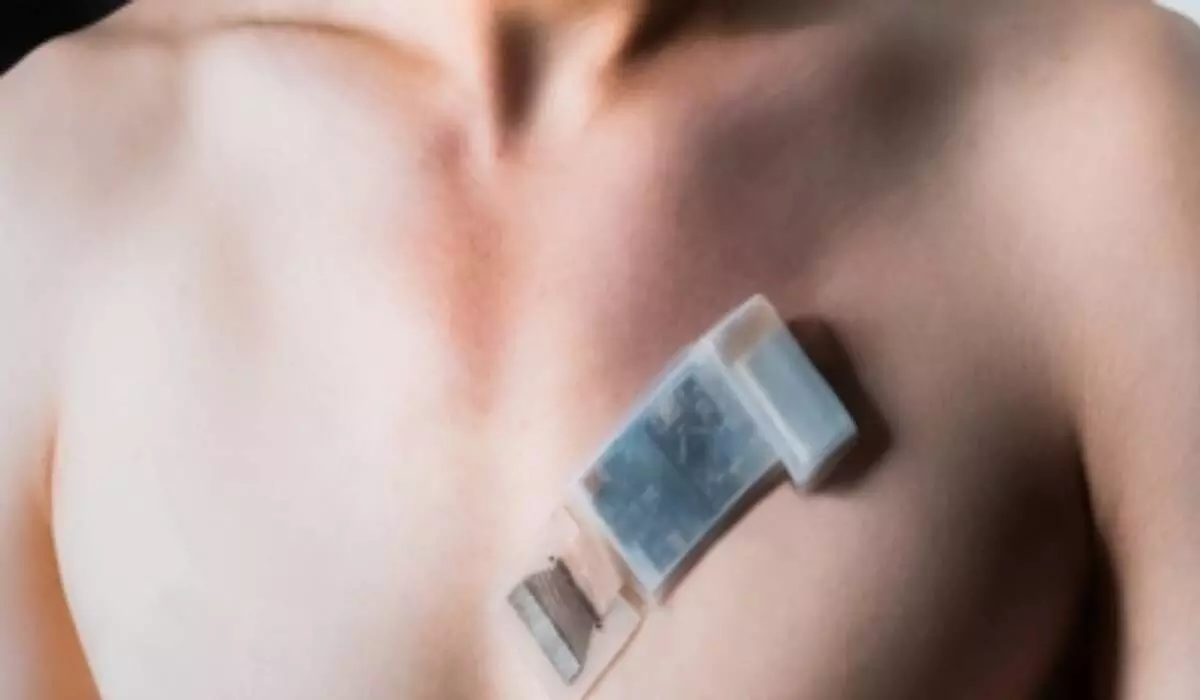 New wearable ultrasound system can monitor BP, heart function on the go