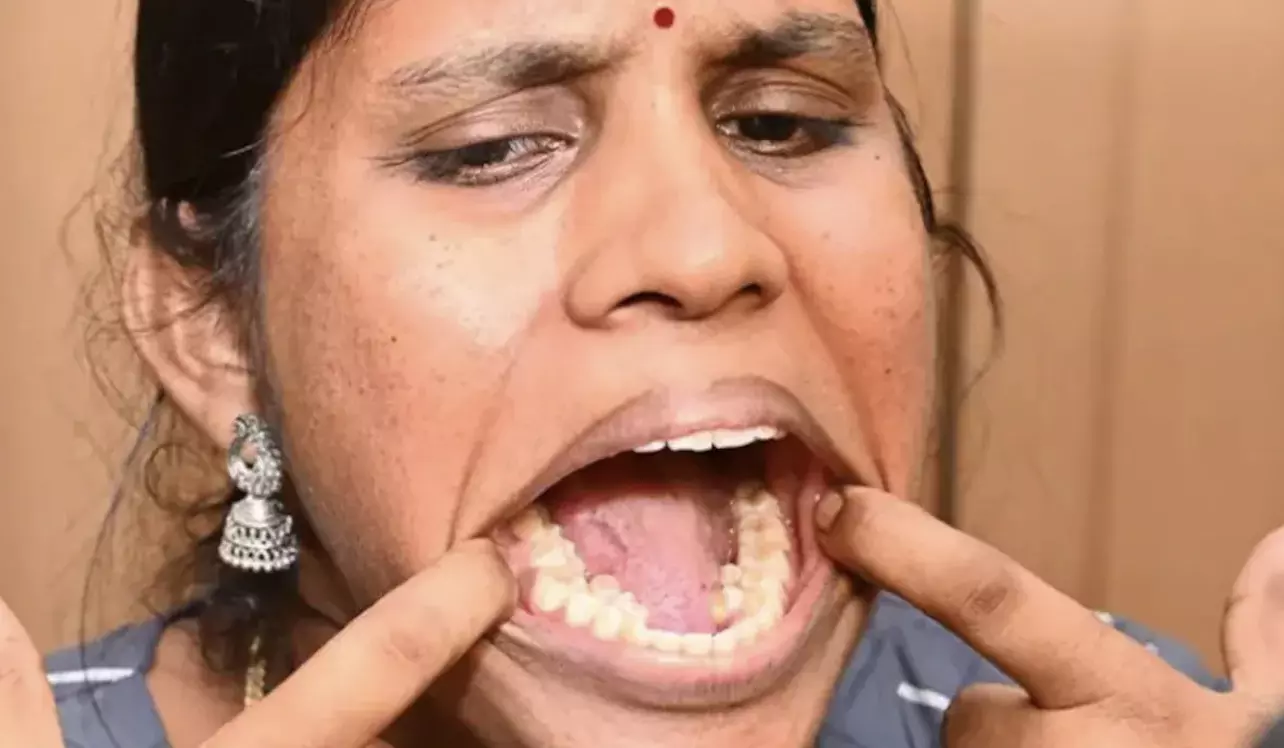 Indian woman receives Guinness World Record with thirty eight teeth