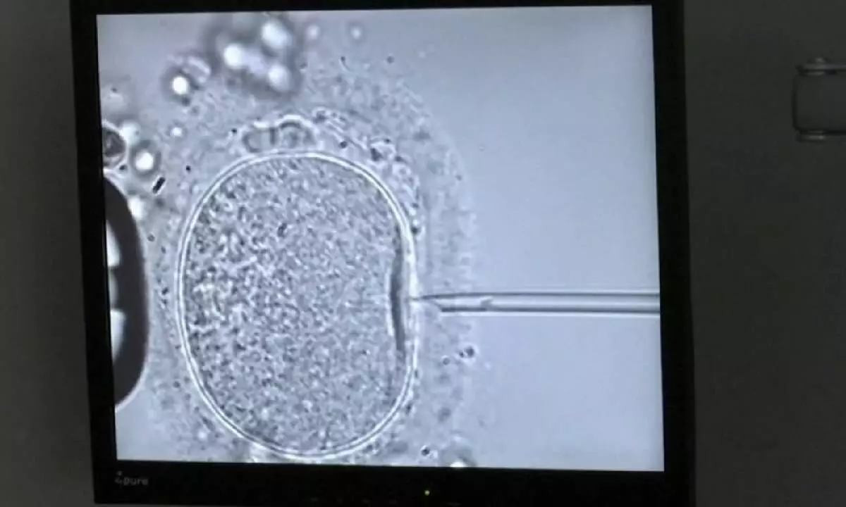 More women from rural India thinking of IVF, costs a concern: Experts