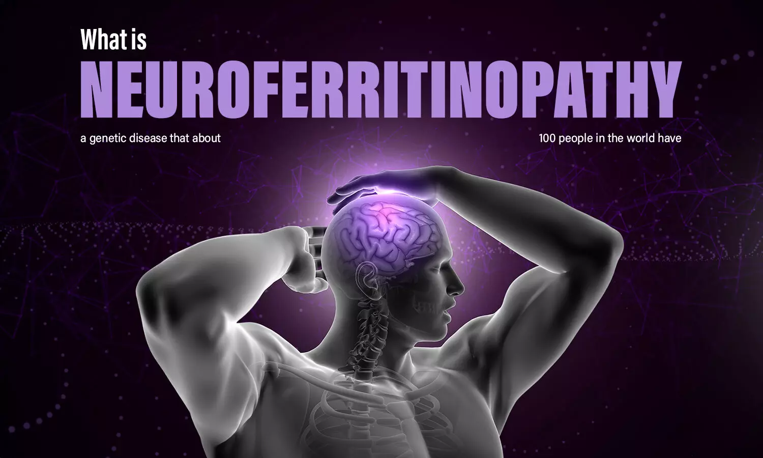 Exploring Neuroferritinopathy: All you need to know about the rare condition