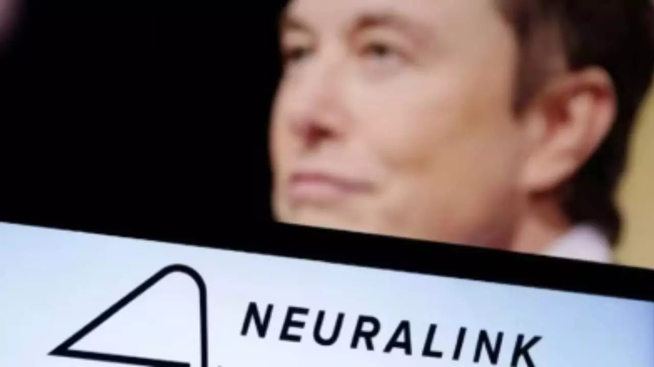 Second Neuralink chip recipient progressing well: Elon Musk