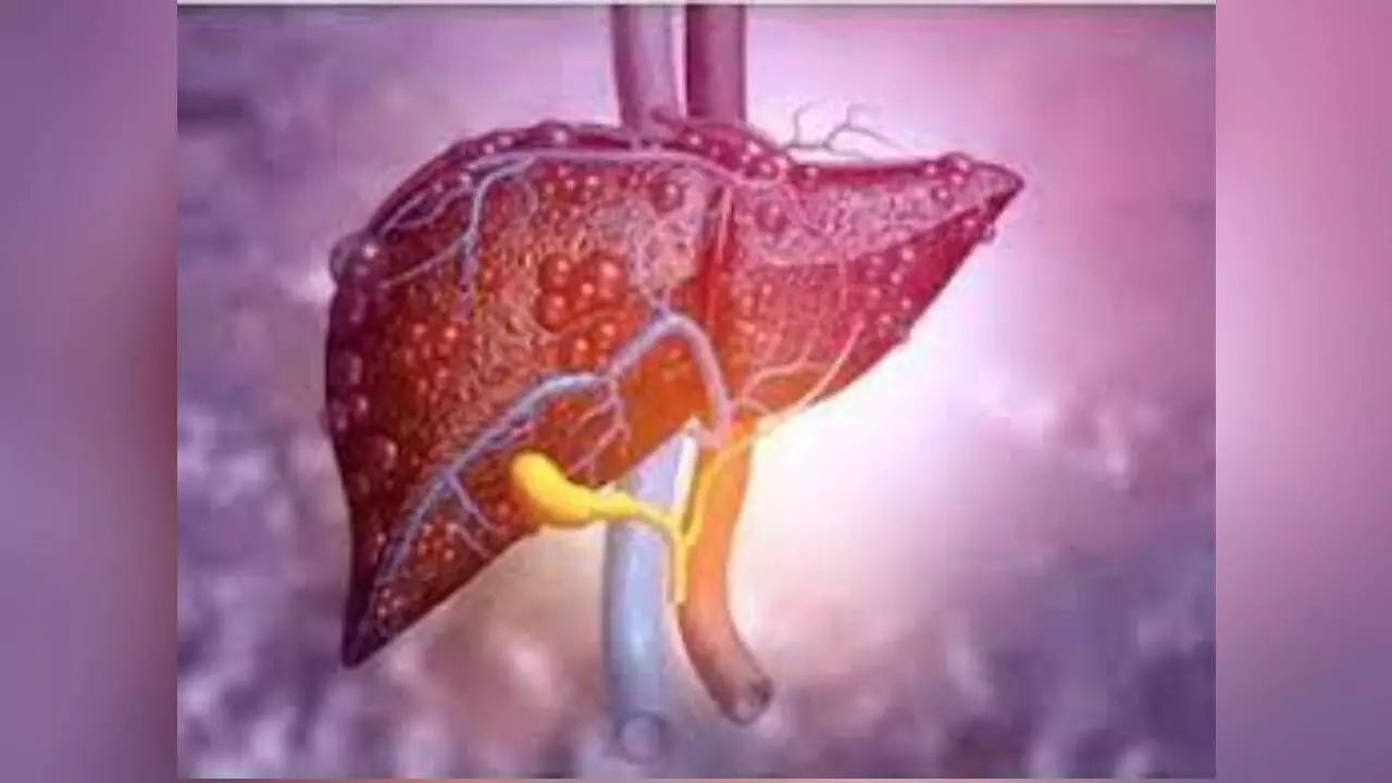 Study Shows Poor Sleep May Worsen Fatty Liver Disease