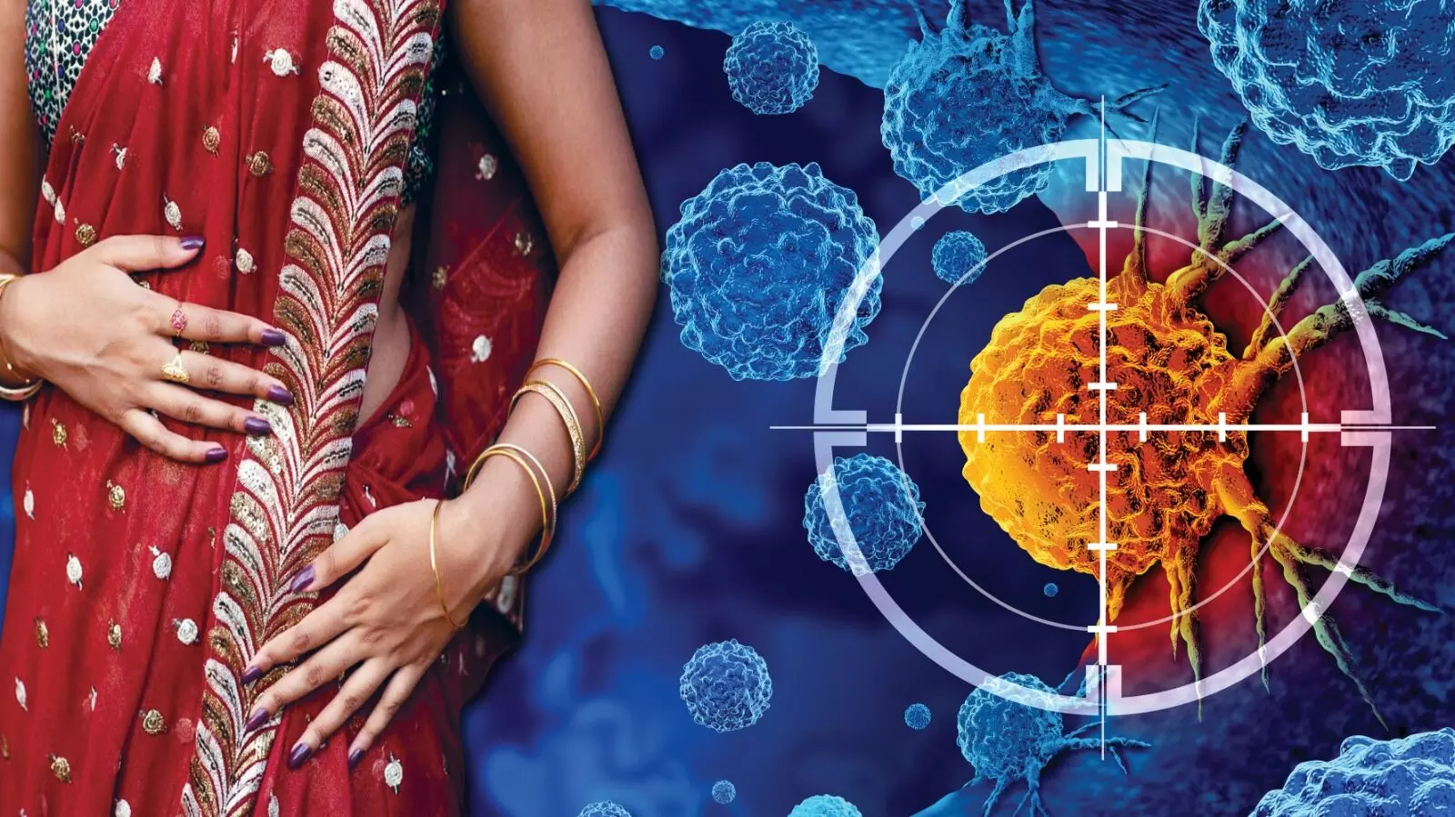 What is Saree and Petticoat Cancer? Is It Real? How to Prevent It?