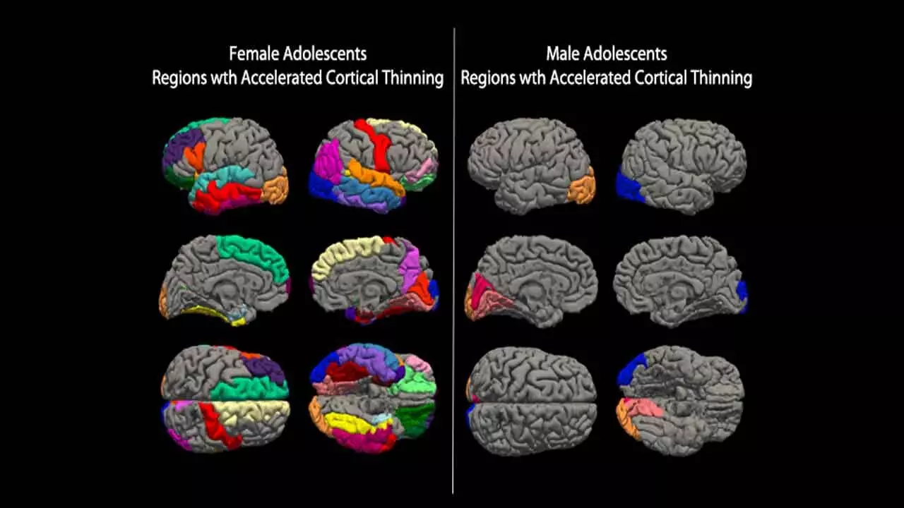 The Damage Caused By Covid On The Developmental Brain Biology Of Teens Needs Prioritised Attention