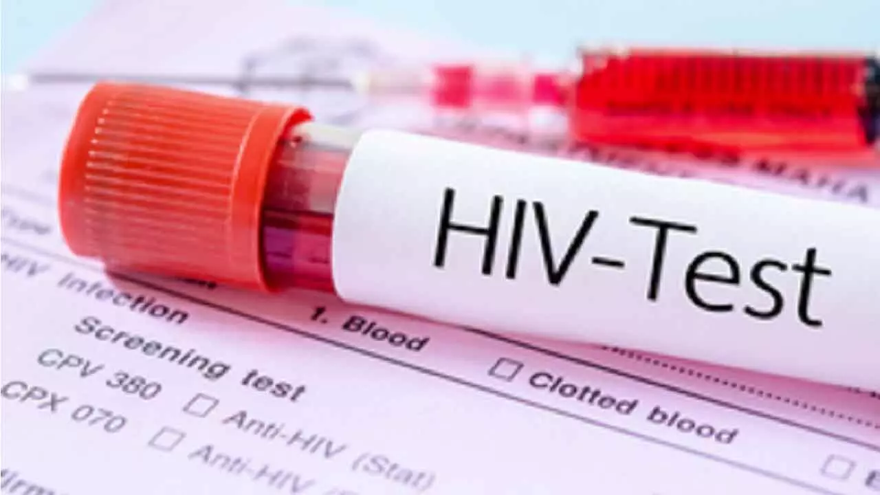 Diagnosed HIV Prevalence To Reach Over 2.2mn In 2033: Report