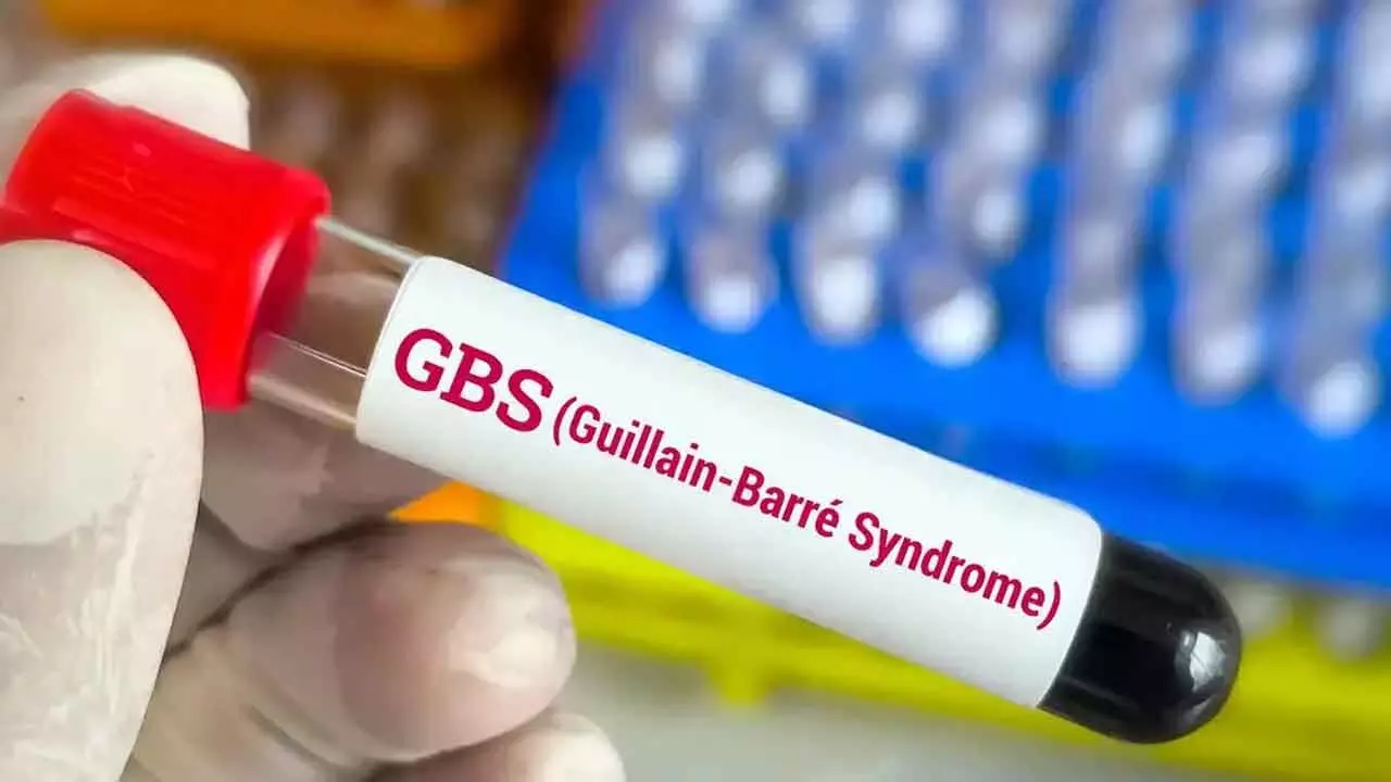 TG Woman Diagnosed With GBS Disease